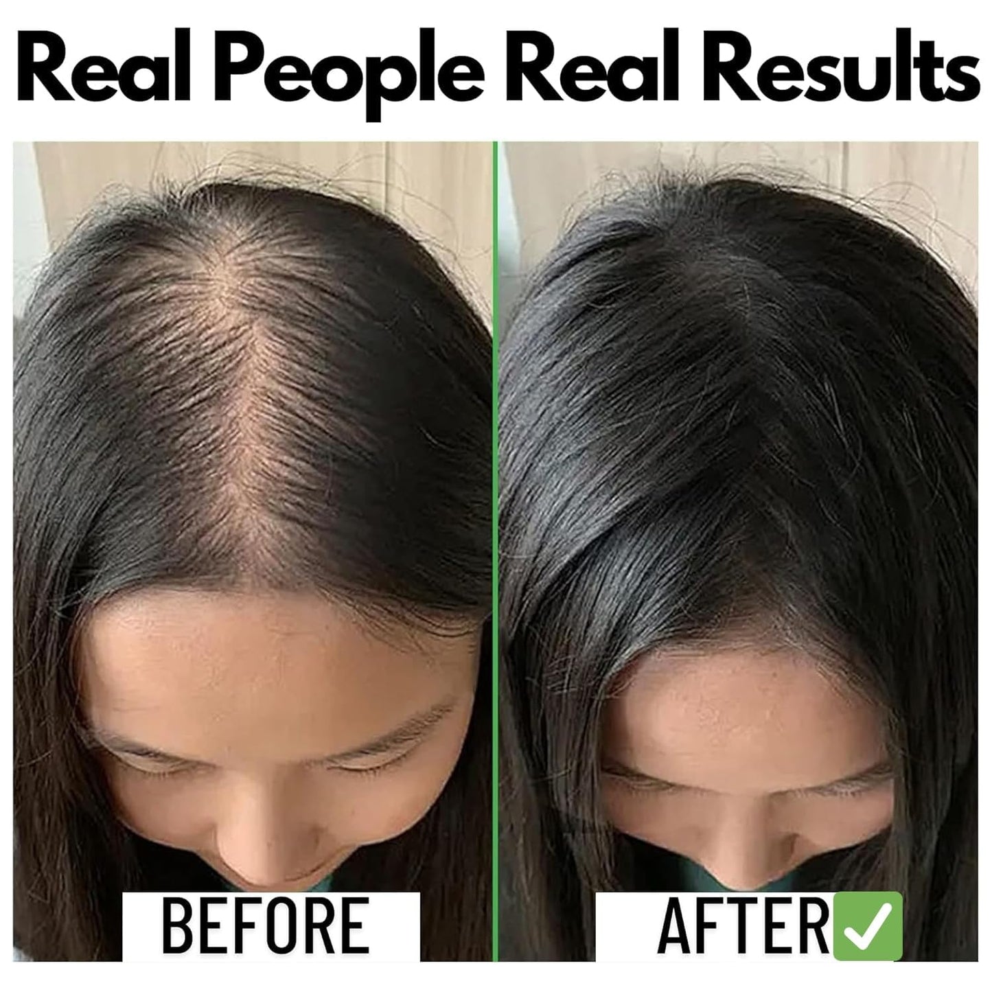 Rosemary Water Spray For Hair Growth & Thickness