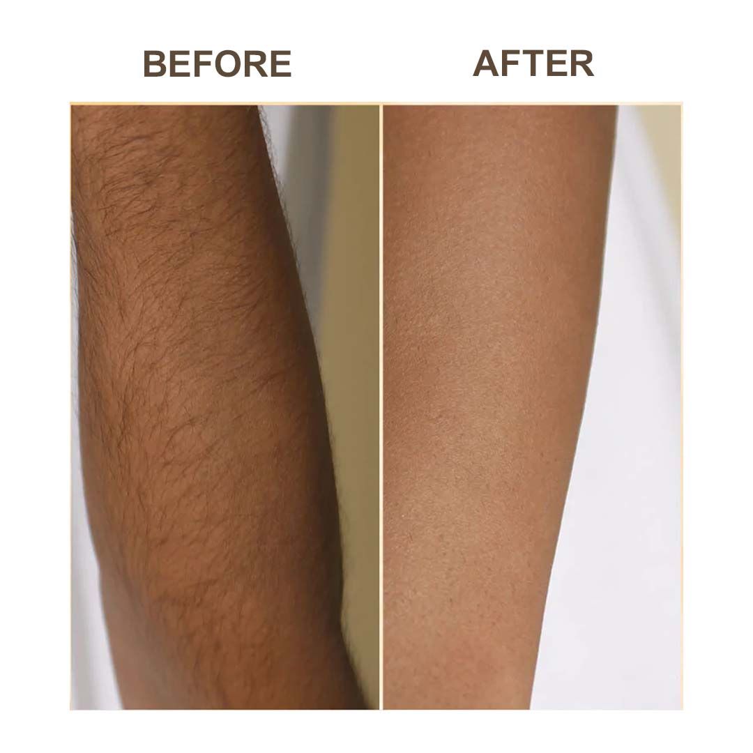 Haldi Hair Removal Powder - 100gm