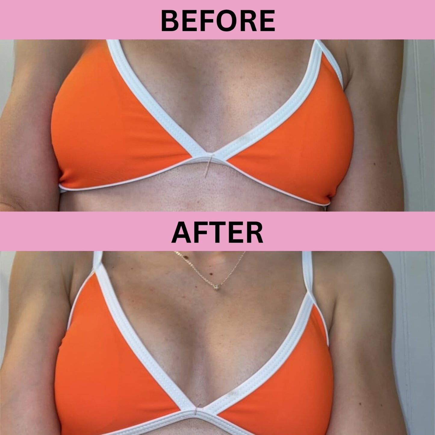 Breast Lotion For Breast Size Growth