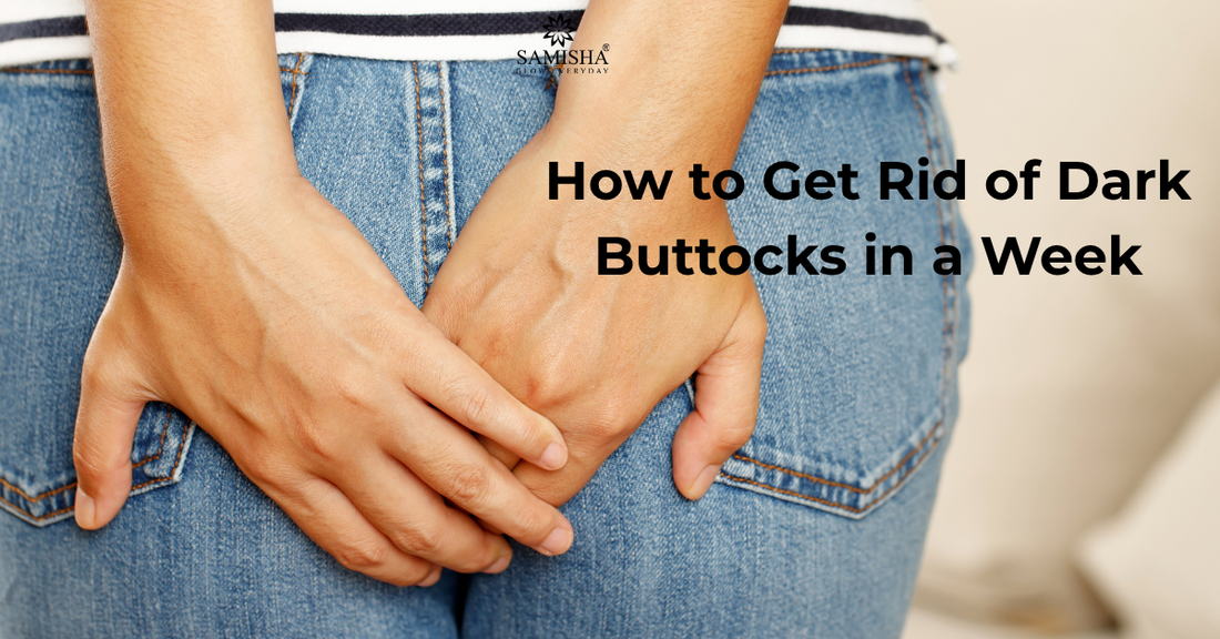 How to Get Rid of Dark Buttocks in a Week