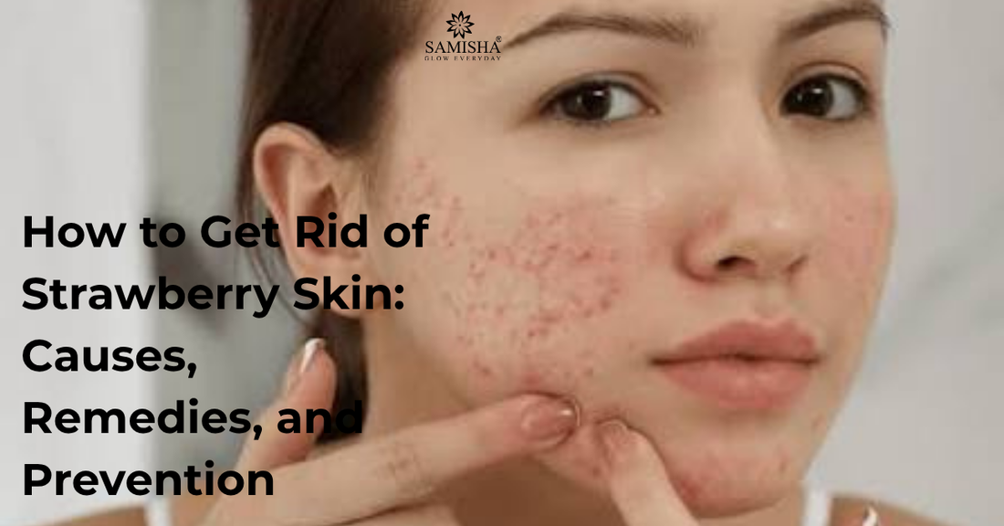 How to Get Rid of Strawberry Skin: Causes, Remedies, and Prevention