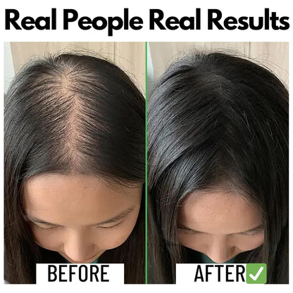 Rosemary Water Spray For Hair Growth & Thickness